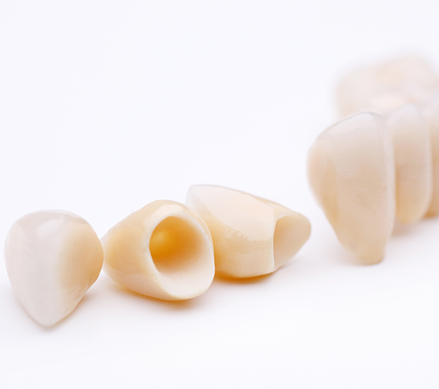 Miramar Dental Crowns and Dental Bridges