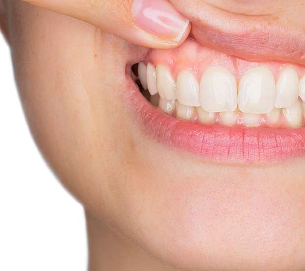 Miramar Gum Disease
