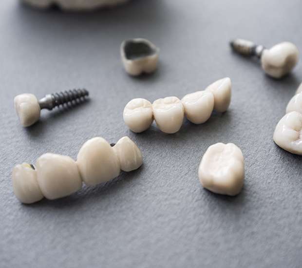 Miramar The Difference Between Dental Implants and Mini Dental Implants