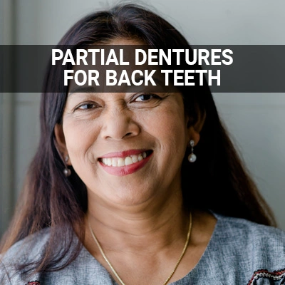 Visit our Partial Dentures for Back Teeth page
