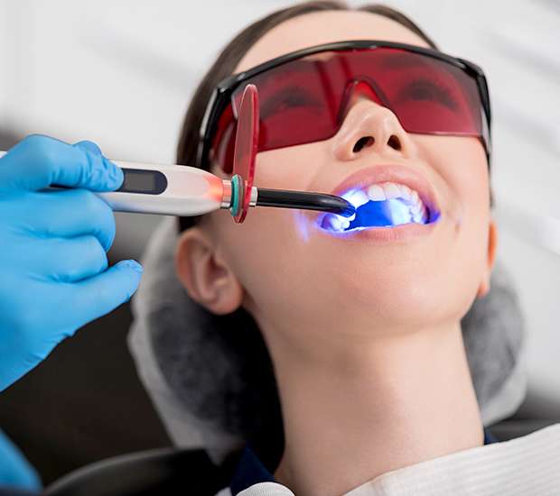 Miramar Professional Teeth Whitening